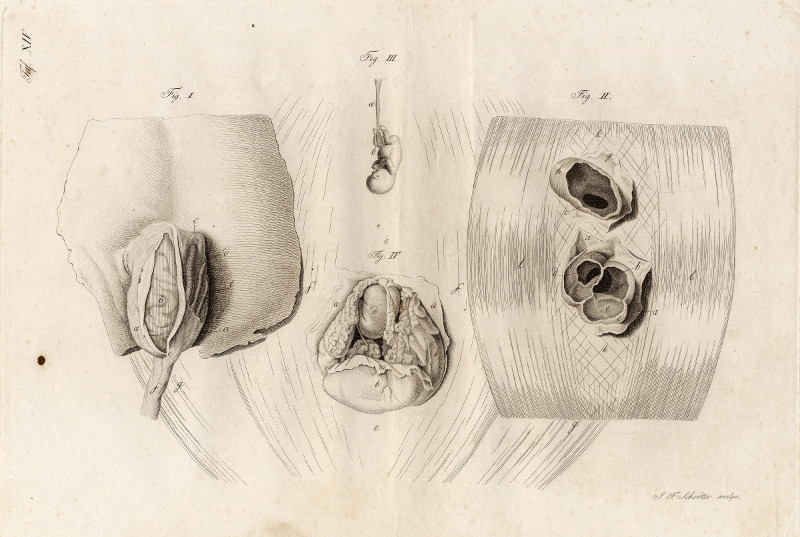 afbeelding van prent Anatomische prent van Johann Friedrich Schröter (Geneeskunde, )