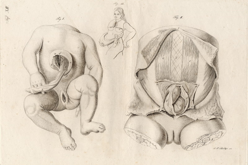 afbeelding van prent Anatomische prent van een kind van Johann Friedrich Schröter (Geneeskunde, )