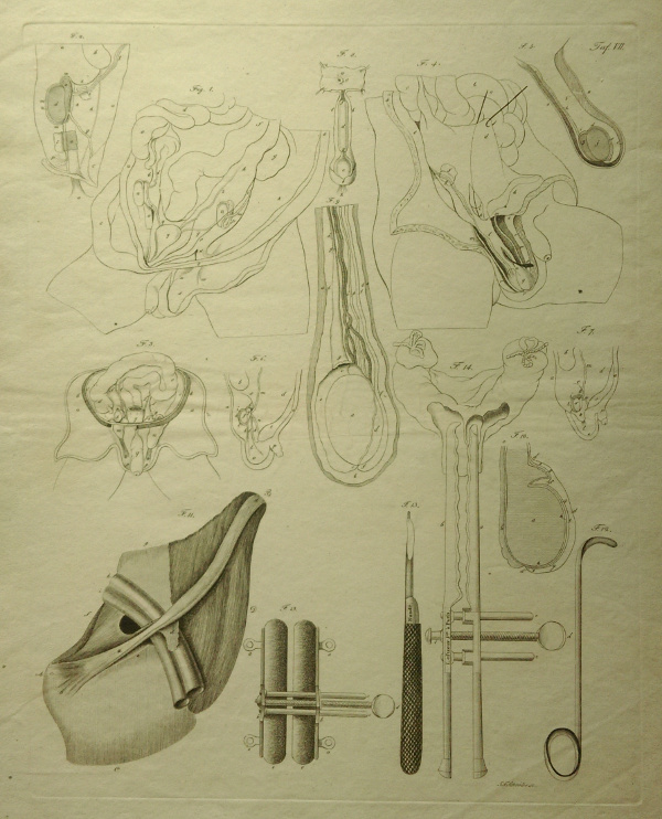 afbeelding van prent Anatomische prent van mannelijk geslachtsorgaan van Johann Friedrich Schröter (Geneeskunde, )