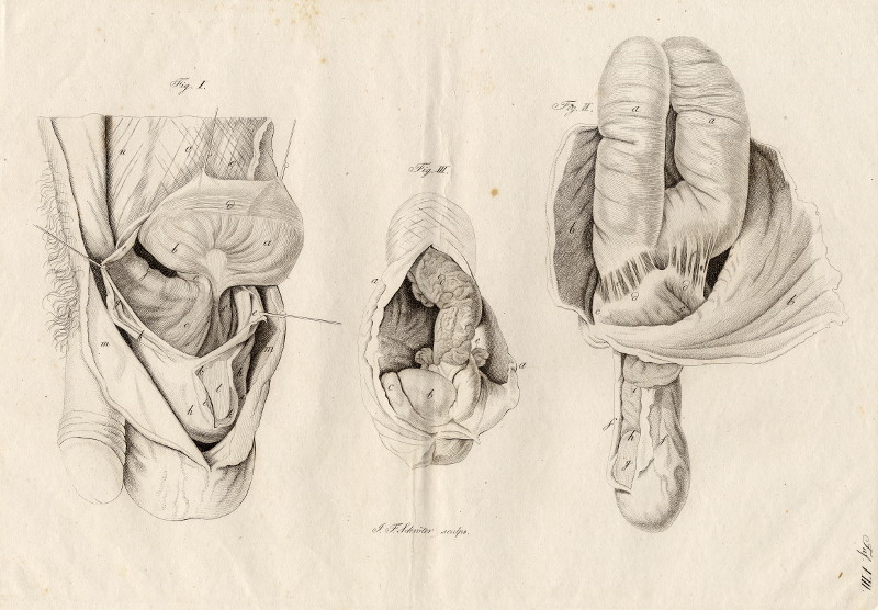 afbeelding van prent Anatomische prent van mannelijk geslachtsorgaan van Johann Friedrich Schröter (Geneeskunde, )