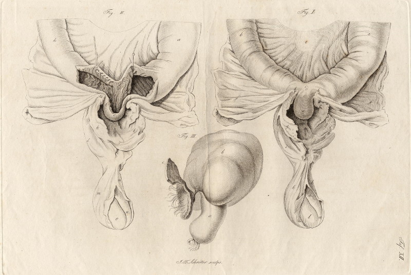 afbeelding van prent Anatomische prent van Johann Friedrich Schröter (Geneeskunde, )