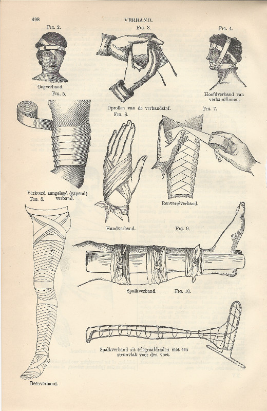 afbeelding van prent Verband van Winkler Prins (Geneeskunde, )