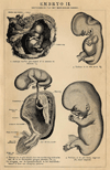 Prent Embryo II